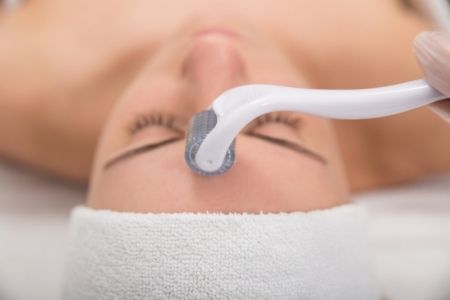 Dermaroller e vantaggi del trattamento per il viso
